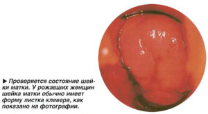 Рыхлая шейка матки что это значит. Какой должна быть здоровая шейка матки