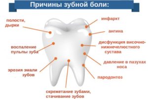 Может ли быть температура от зубной боли у взрослых и детей: симптомы и лечение. Может ли подняться температура от зубной боли