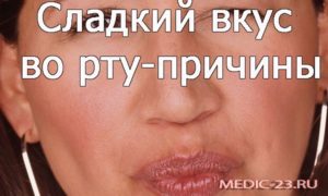 Причины неприятного привкуса во рту: от непонятных ощущений мыла и лекарств до вкуса пластмассы и спирта. Сладкий привкус во рту: причины, что значит, лечение Почему во рту стоит молочный вкус