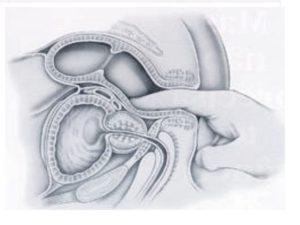 Как сделать массаж предстательной железы дома. Массаж простаты дома — за и против