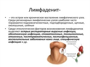 Какой врач лечит лимфоузлы? Воспалился лимфоузел: причины, к какому врачу обратиться, методы лечения