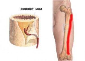 Воспаление надкостницы голени лечение мази. Особенности воспаления надкостницы голени и его лечение. Понятие и характеристика болезни