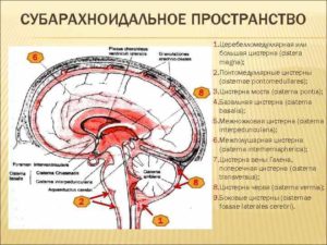 Кистовидное расширение субарахноидального пространства мозжечка. Что представляет собой субарахноидальное пространство