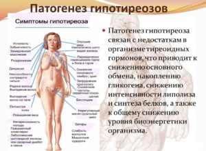 Гипотиреоз – молчаливый вор, крадущий жизнь. Симптомы, лечение гипотиреоза. Гипотиреоз: симптомы у женщин, принципы лечения