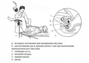 Гинекологический массаж: показания и эффективность процедуры. Массаж матки в домашних условиях