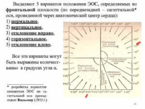 Пограничное отклонение эос влево во фронтальной плоскости. Показатели определения приведены ниже. С какой целью определяется ЭОС