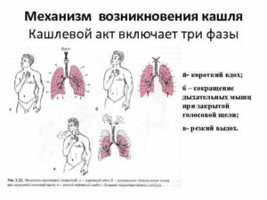 Почему при вдохе хочется кашлять? Причины кашля на выдохе