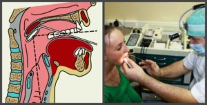 Фарингоскопию проводят с помощью. Что такое фарингоскопия, ее виды и техника проведения. Показания к фарингоскопии