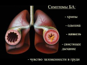 Тяжело дышать и хрипы в легких. Чем опасен кашель с хрипами