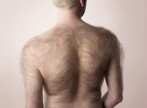Почему мало волос на теле причины. Украшает ли мужчину повышенный волосяной покров