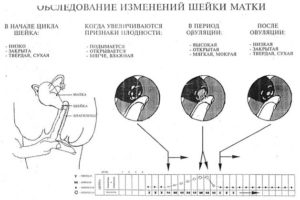 Шейка матки за неделю до месячных. Как изменяется шейка матки перед месячными