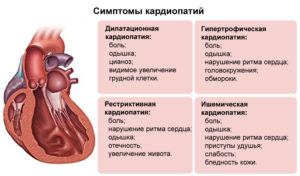 Большое сердце болезнь лечение. Диагноз большое сердце что это такое. Причины роста размеров сердца