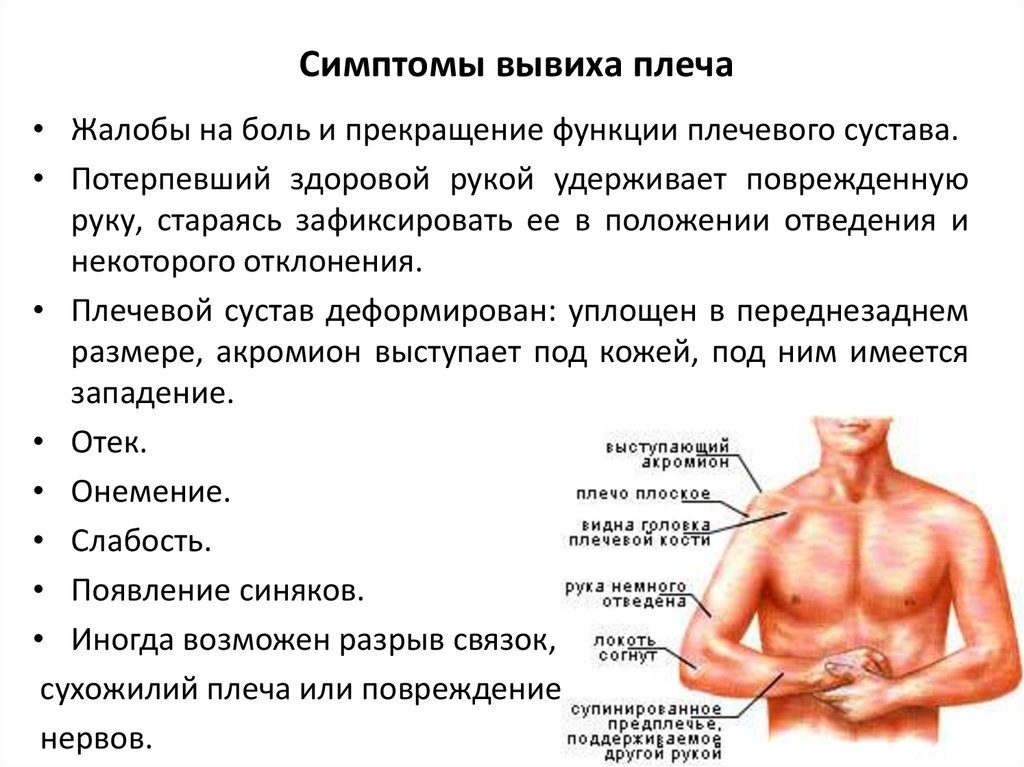 Вывих плечевого сустава локальный статус. Основные и абсолютные признаки вывиха Осложнения вывиха плеча