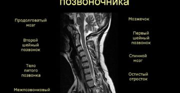 Противопоказания к мрт шейного отдела позвоночника. МРТ шейного отдела позвоночника: как проходит и что показывает процедура. Опухолевые заболевания кости