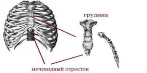 Воспаление мечевидного отростка грудины причины. Мечевидный отросток грудины увеличился и болит- как быть