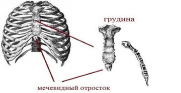 Воспаление мечевидного отростка грудины причины. Мечевидный отросток грудины увеличился и болит- как быть