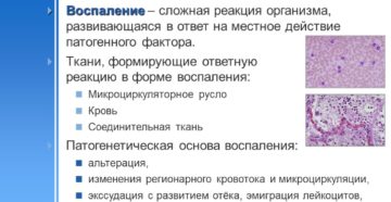 Как определить очаг воспаления в организме. Как проходит воспаление. Зависеть они будут от формы процесса