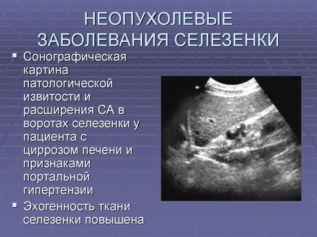 Увеличение селезенки у ребенка 3 лет. Селезенка симптомы заболевания лечение у детей