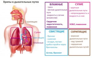 Тяжело дышать и хрипы в легких. Чем опасен кашель с хрипами