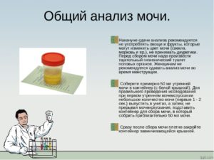 Какие болезни показывает анализ мочи. Как собрать и сдать общий анализ мочи правильно