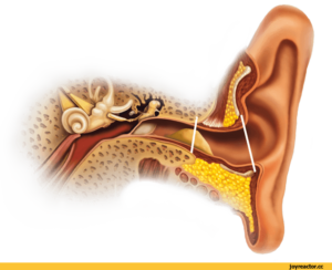 Откуда берется сера в ушах и как бороться с пробками? Почему в ушах образуется сера