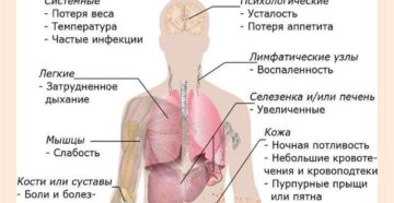 Можно ли вылечить лейкемию или нет. Лейкоз крови у взрослых: первые признаки и симптомы, причины болезни, лечение