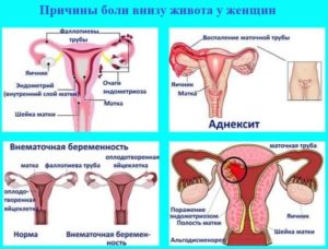 Почему болит живот если нет месячных. Из-за чего болит внизу живота без наступления месячных