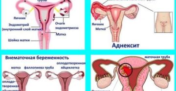 Почему болит живот если нет месячных. Из-за чего болит внизу живота без наступления месячных