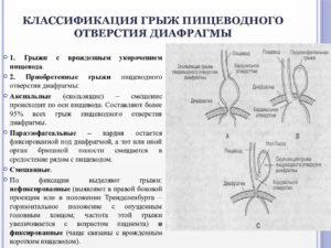 Скользящая диафрагмальная грыжа. Причины появления скользящей кардиальной грыжи и ее лечение. Диета и питание