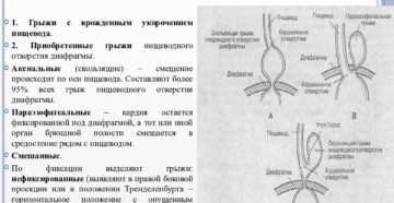 Скользящая диафрагмальная грыжа. Причины появления скользящей кардиальной грыжи и ее лечение. Диета и питание