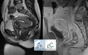Особенности мрт малого таза у мужчин и подготовка к ней. Что показывает МРТ органов малого таза у мужчин? Показания к проведению томографии малого таза у мужчин