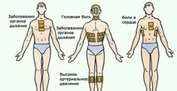 Как правильно использовать горчичники от давления. Горчичники от насморка куда ставить