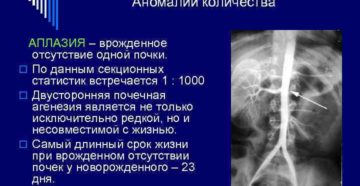 Аплазия почки: опасности и подводные камни. Что такое агенезия и аплазия почки? Агенезия аплазия