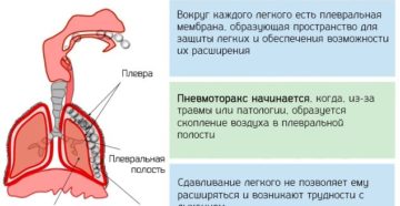 Последствия после пневмоторакса. Пневмоторакс: что это такое? Причины, симптомы и лечение пневмоторакса