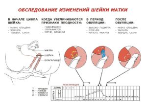 За сколько до месячных опускается шейка матки. Изменения в матке в период менструации