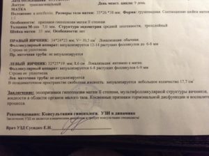 Жидкость в позадиматочном пространстве. Жидкость в позадиматочном пространстве – что это означает