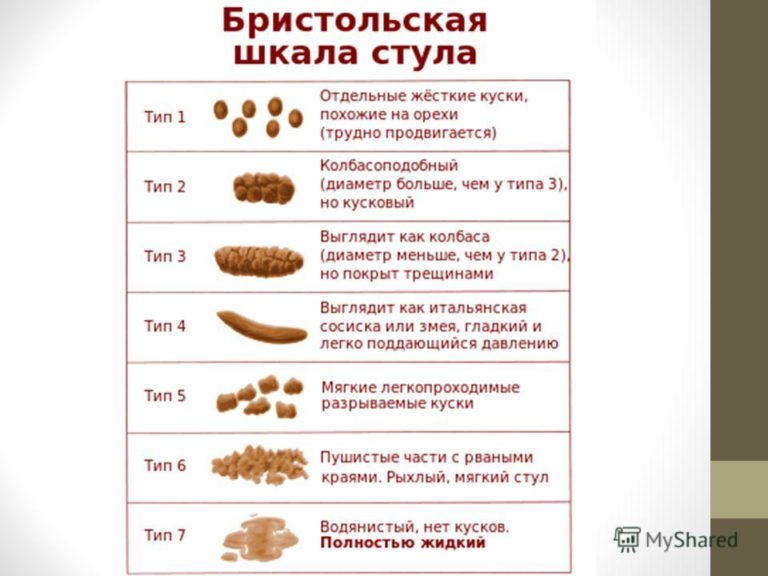 Светлый стул причины