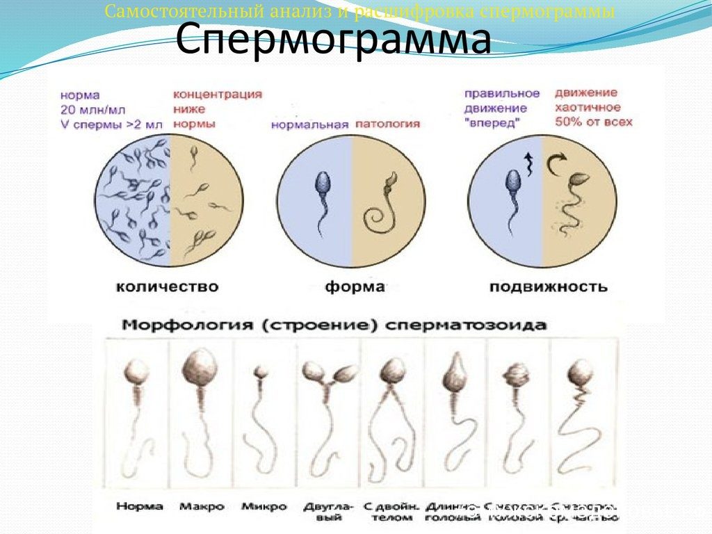 Семенная плазма, ее состав и патологии. Анализ спермы: норма и патология