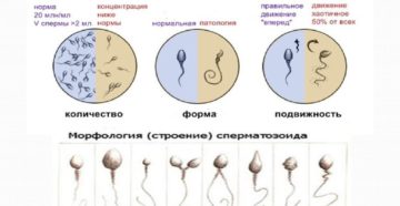 Семенная плазма, ее состав и патологии. Анализ спермы: норма и патология