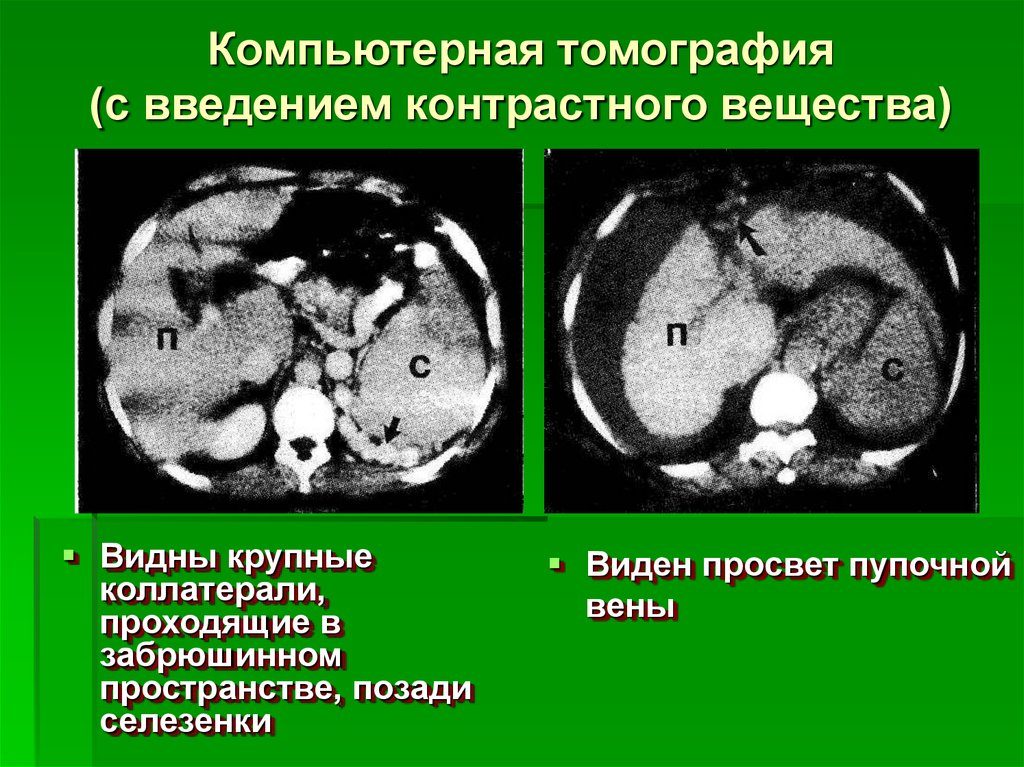 Кто должен вводить контрастное вещество. КТ с контрастным усилением — что покажет исследование? Вредно ли контрастное вещество