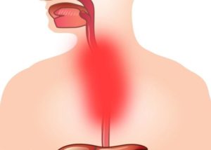 Еда не проходит в пищевод чем грозит. Дискомфорт в пищеводе