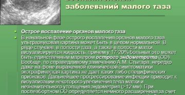 Воспаление малого таза у женщин. Воспаление органов малого таза: причины возникновения проблемы