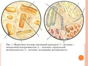 Копрограмма — Общий анализ кала. Креаторея — мышечные волокна в кале: причины и лечение