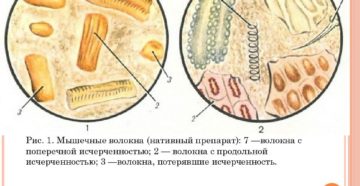 Копрограмма — Общий анализ кала. Креаторея — мышечные волокна в кале: причины и лечение