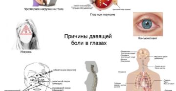 Почему больно когда поднимаю глаза вверх. Боль при движении и повороте глаз: причины, лечение и профилактика