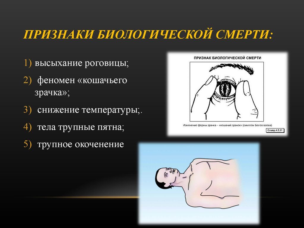 Клиническая и биологическая смерть определение признаки. Клиническая и биологическая смерть понятие о клинической и биологической смерти