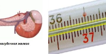 Может ли быть температура при панкреатите, что делать если повысилась. Когда поднимается температура при панкреатите и что делать