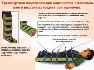 Стандартные средства иммобилизации. Иммобилизация конечности при переломе. Шины для транспортной иммобилизации. Транспортная иммобилизация при сдавлении конечностей.