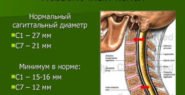 Позвоночный мозг. Сагиттальный размер позвоночного канала. Отделы позвоночника в норме