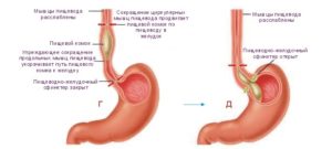 Пища плохо проходит по пищеводу причины. Не проходит пища в желудок